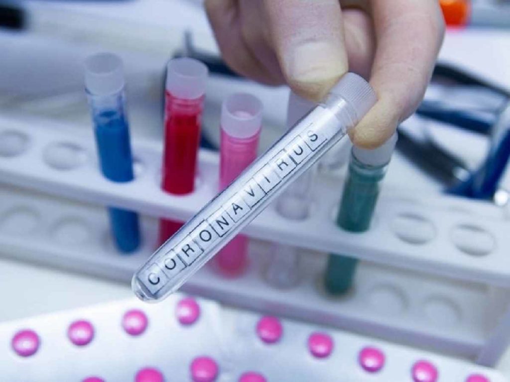 CORONAVIRUS – 40 nuovi casi in Canavese; i ricoverati sono 248 1 CORONAVIRUS – 40 nuovi casi in Canavese; i ricoverati sono 248
